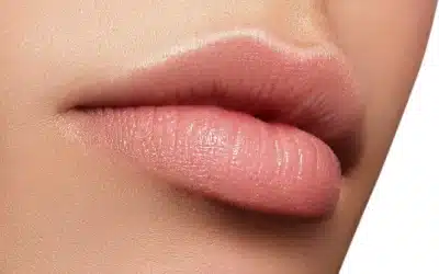 What are Fillers?